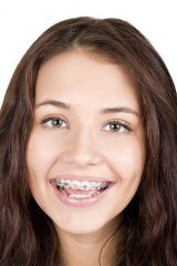 Misconceptions About Orthodontics