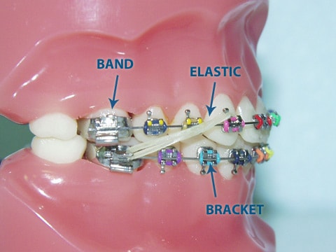 Milberg Orthodontics