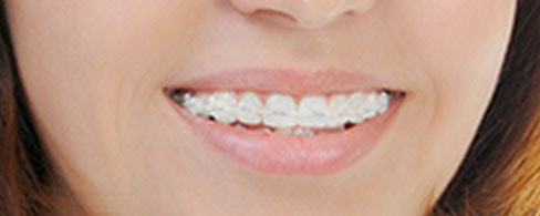 Milberg Orthodontics