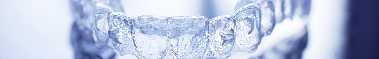 Aligners FAQs