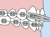 Milberg Orthodontics