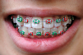 What role do elastics (rubber bands) play in orthodontics