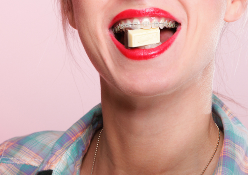 Not-So-Sweet Sweets: The five worst candies to eat during orthodontic treatment