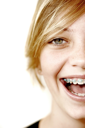 Besides straight teeth, what are the benefits of braces