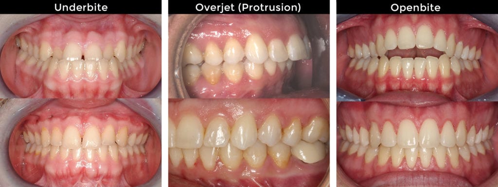 surgical before after